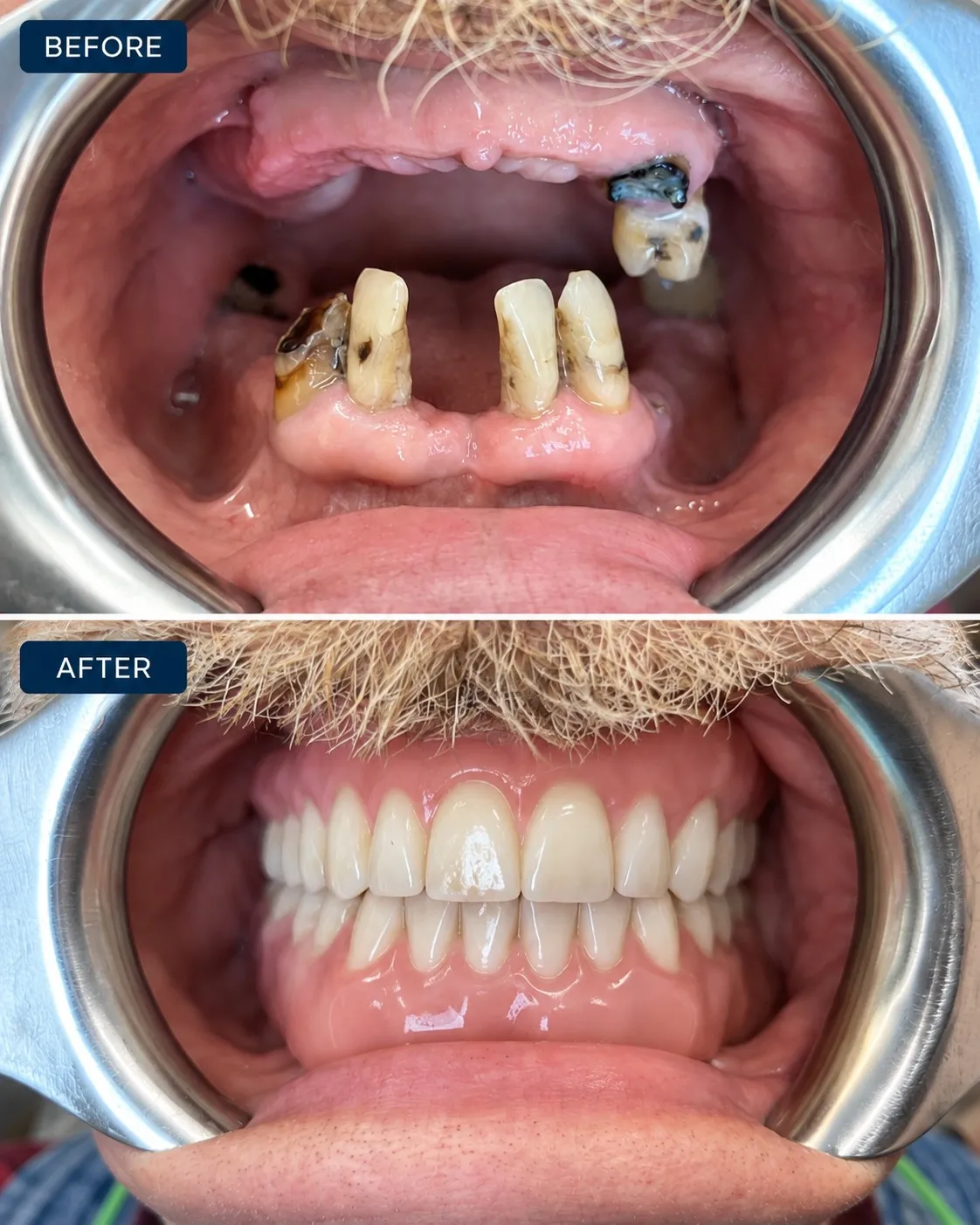 Actual Little Mountain Dentistry patient smile before treatment